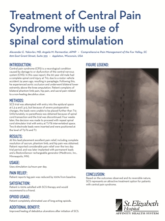 Treatment of Central Pain Syndrome with use of spinal cord stimulation.jpg